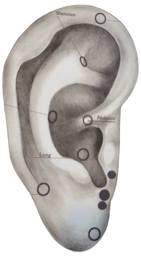 Auriculotherapie